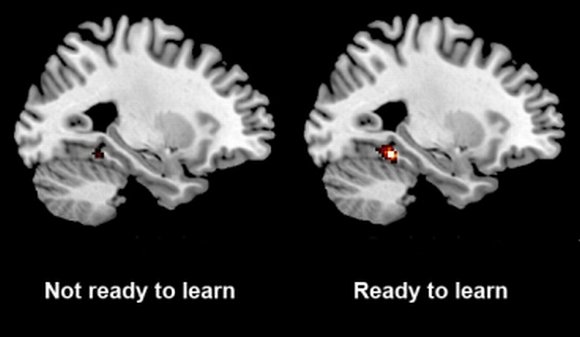 Brain scans activity