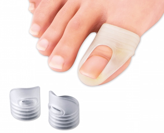 pincer-nail-supporter-ingrown-toenail-1