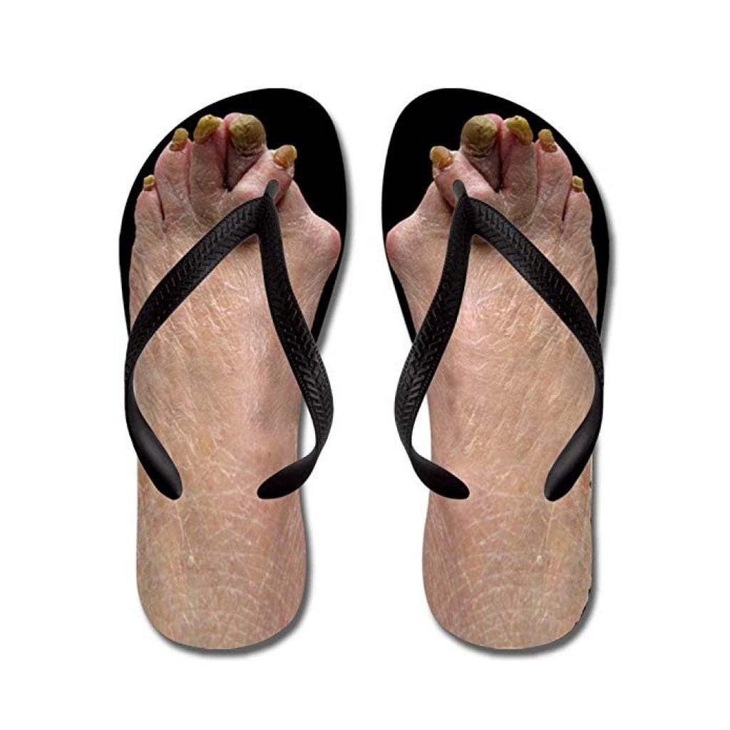 sandals for people with ugly toes