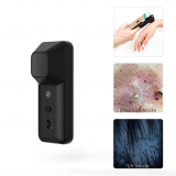 SKIARY Smartphone Dermatoscope