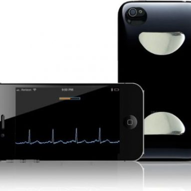 iPhone Heart Monitor detects heart rhythm irregularities